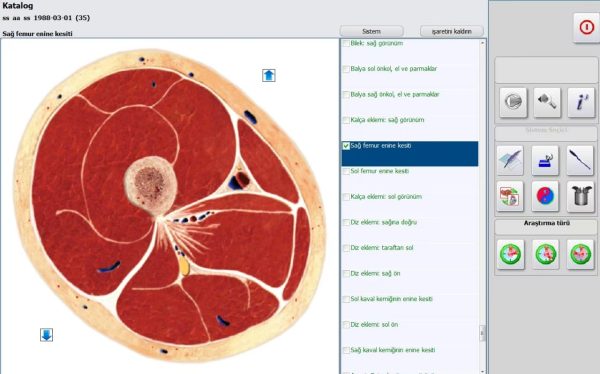 Wellness Analyzer Pro 18D Nls Cihazı