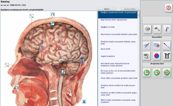 Wellness Analyzer Pro 18D Nls Cihazı